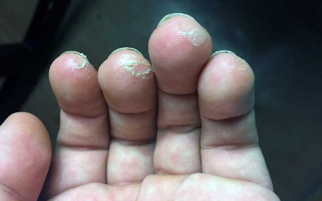 Does Electric Guitar Hurt Your Fingers  